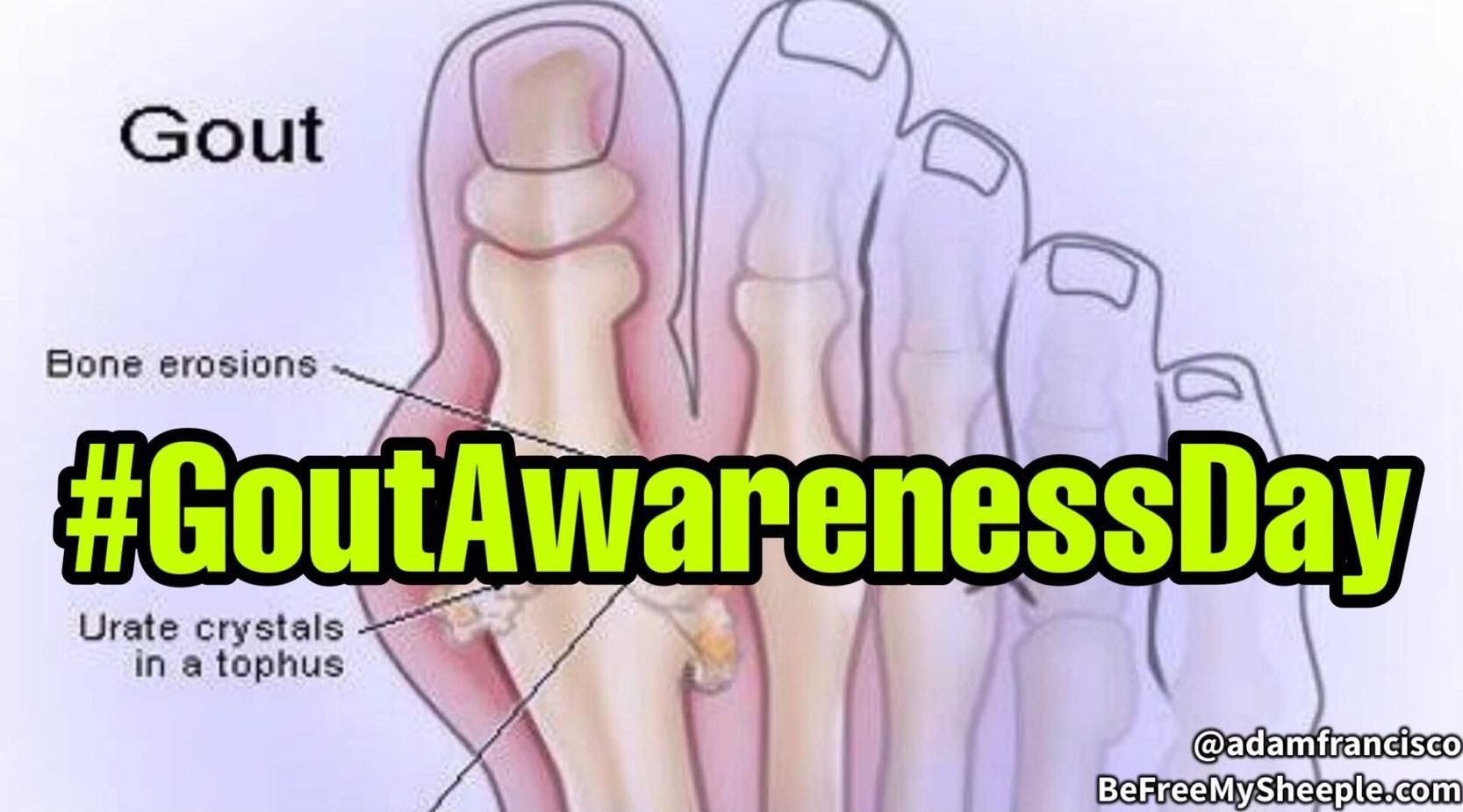 Gout Awareness Day